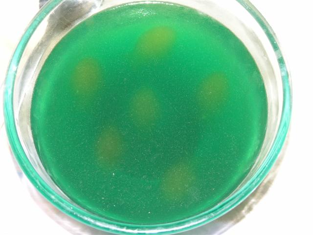 Orange jelly fish in blue jelly sea